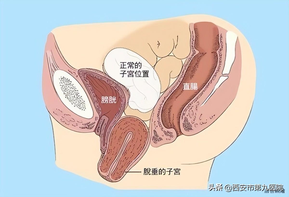 睪丸下垂松弛的原因及治療方法，睪丸下垂松弛的原因與治療方法解析