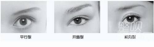 平扇與開扇雙眼皮，哪種更適合你？哪個更好看？，雙眼皮手術(shù)，平扇與開扇風(fēng)格的選擇與美觀度探討