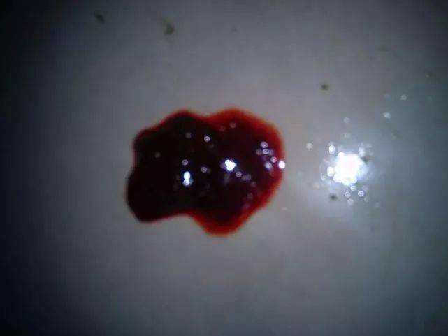 排便時(shí)出現(xiàn)撕裂感及出血，原因與應(yīng)對(duì)措施，排便疼痛撕裂感及出血，原因分析及應(yīng)對(duì)方法