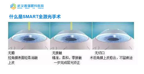 晶體植入近視手術的利與弊，全面解析與深度探討，晶體植入近視手術的利與弊，全面解析與深度探討深度探討及解析近視手術晶體植入利弊