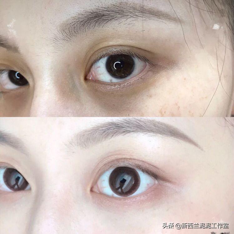 眼紋嚴(yán)重？快速有效的去眼紋方法大揭秘，揭秘快速有效的去眼紋方法，告別眼部皺紋煩惱！