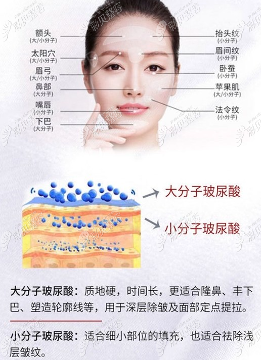 玻尿酸的作用與功效，深入了解玻尿酸的奧秘，玻尿酸的作用與功效揭秘，深入了解玻尿酸的神奇之處