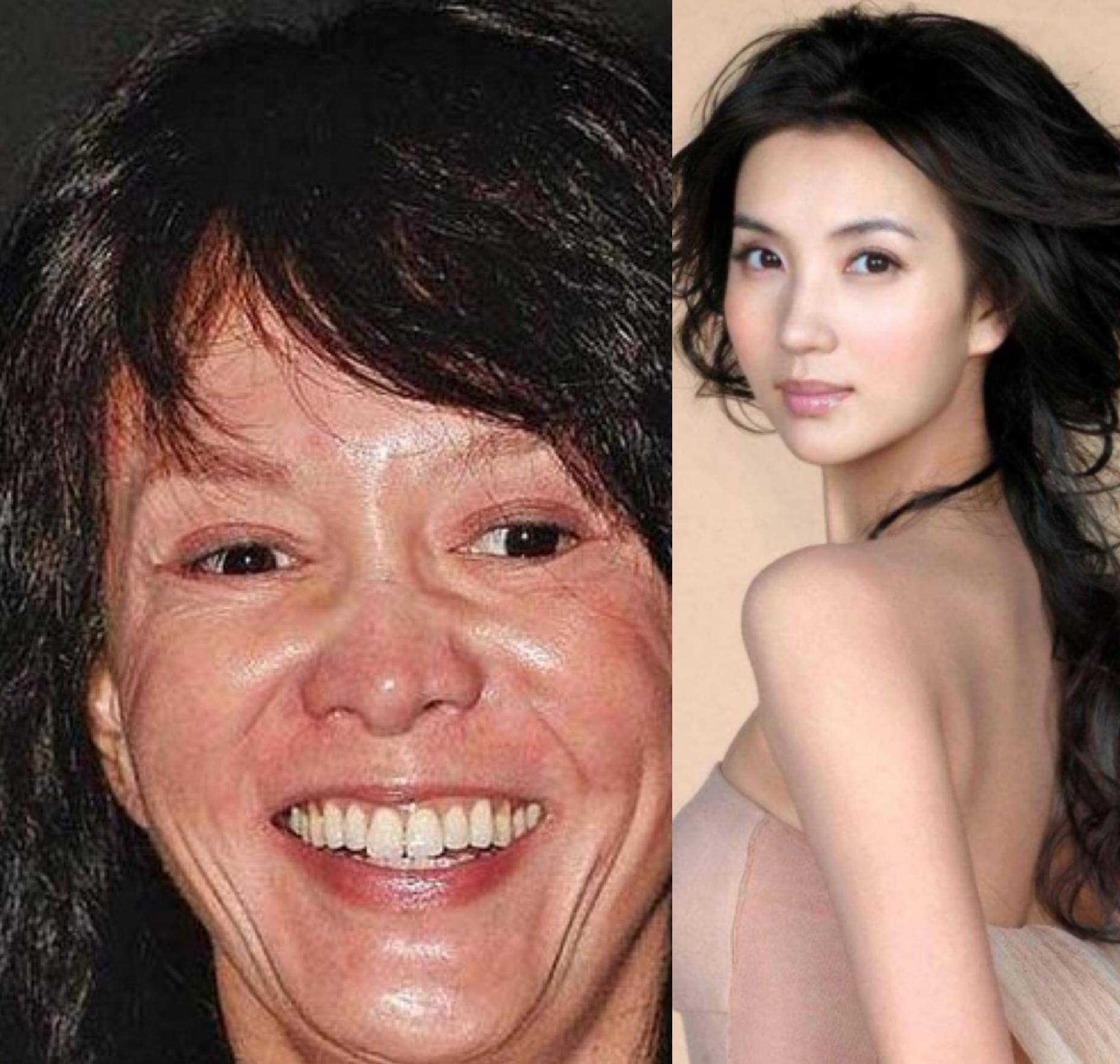 最早整容的明星，揭秘娛樂圈的先驅(qū)者們，揭秘娛樂圈先驅(qū)明星的整容歷程