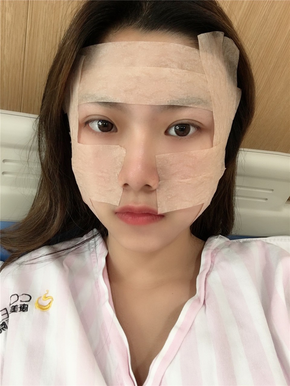 面部吸脂手術(shù)，重塑美麗輪廓的先進(jìn)選擇，面部吸脂手術(shù)，重塑輪廓的先進(jìn)之選