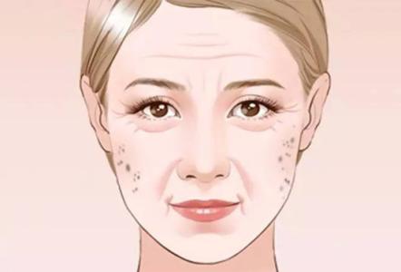 如何有效去除老年斑——全方位解析，全方位解析，有效去除老年斑的方法