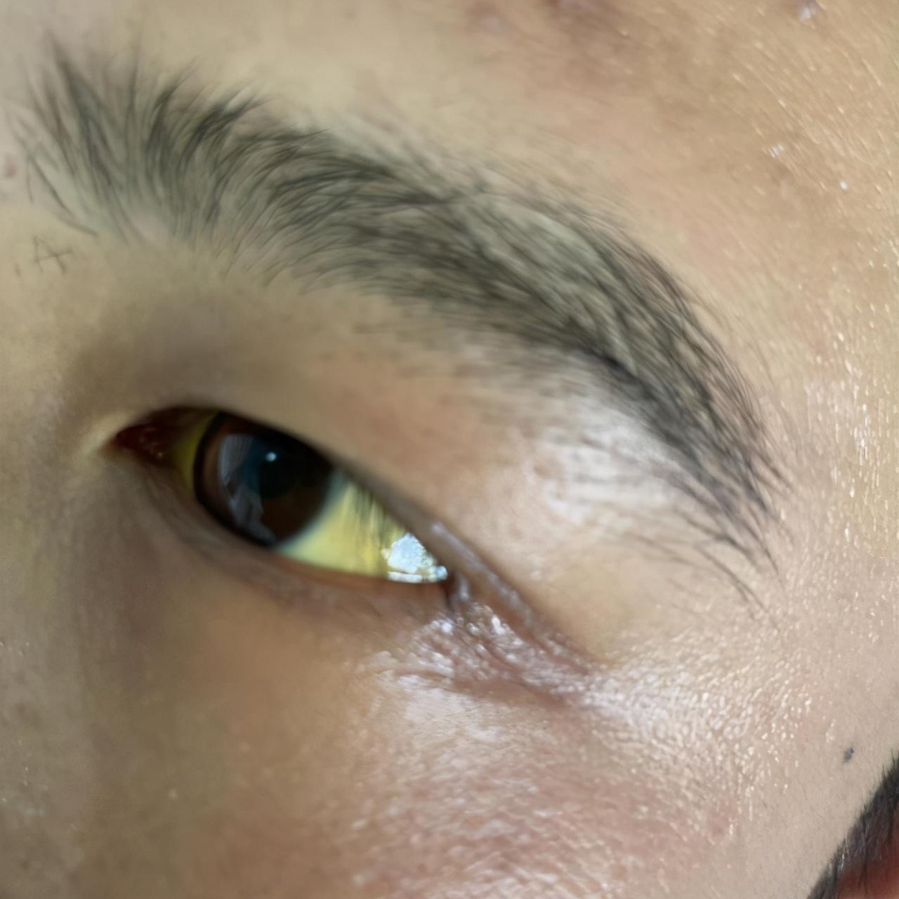 肝功能正常值參考表及其重要性，肝功能正常值參考表，揭示肝臟健康的關(guān)鍵指標(biāo)及其重要性