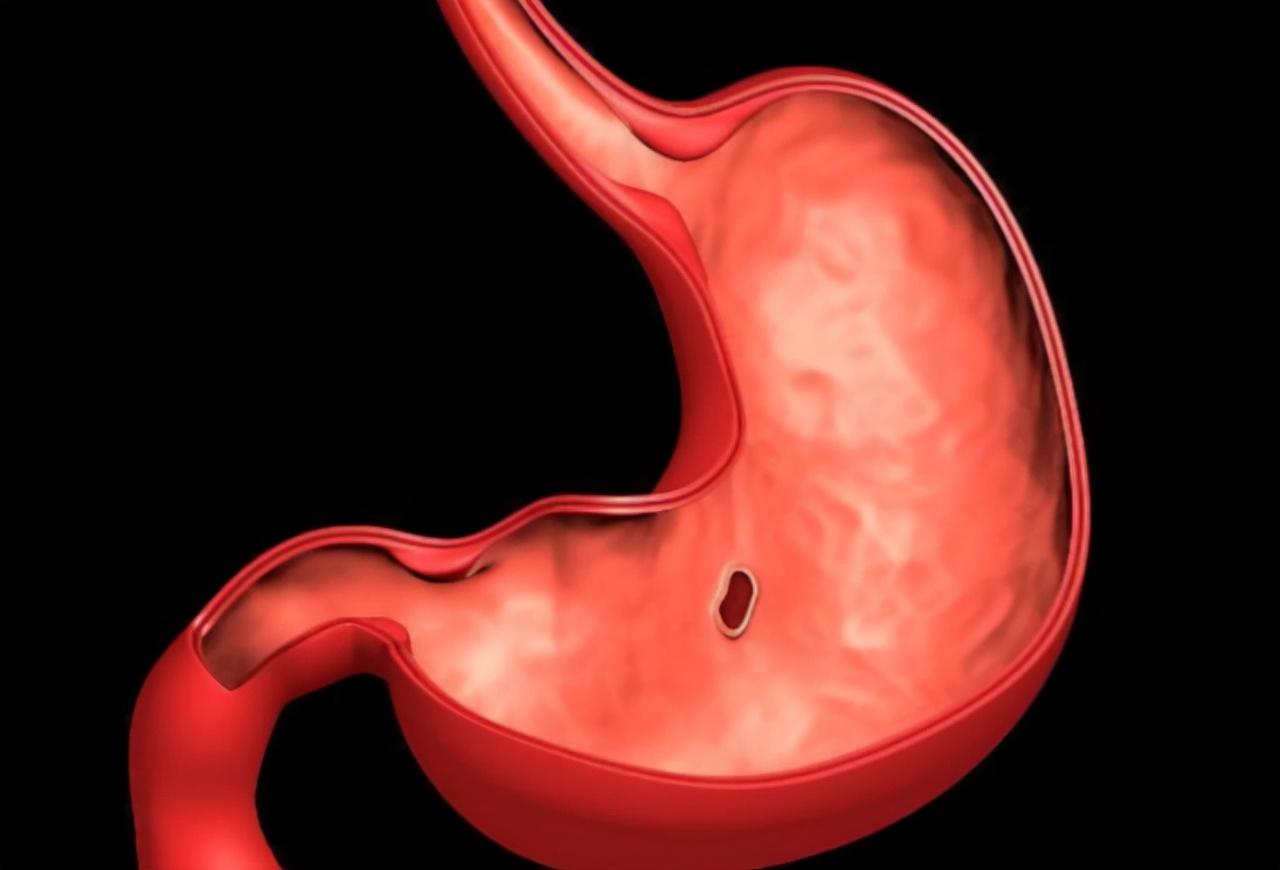 做胃鏡對胃傷害有多大，深入了解與關(guān)注，胃鏡對胃的影響，深入了解與關(guān)注