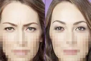 額頭千萬不能打除皺針，了解風(fēng)險(xiǎn)與后果，做出明智選擇，額頭除皺針的風(fēng)險(xiǎn)與后果，明智選擇需了解的內(nèi)容