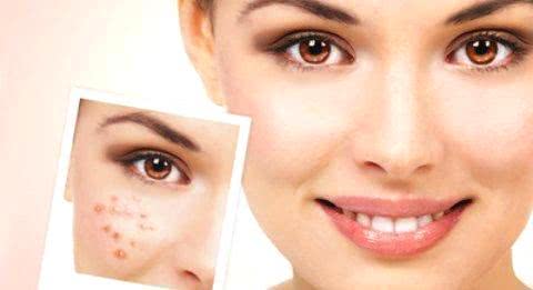 臉上長斑的原因及其影響因素，深度解析，深度解析，臉上長斑的原因及其影響因素