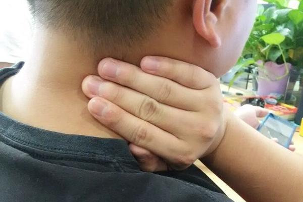 女性甲狀腺早期脖子圖片及其相關(guān)知識與識別，女性甲狀腺早期脖子癥狀圖片及識別與相關(guān)知識