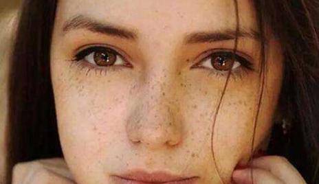如何淡化臉上的斑，多種方法助你擁有無(wú)瑕肌膚，多種方法助你淡化臉部斑點(diǎn)，重塑無(wú)瑕肌膚