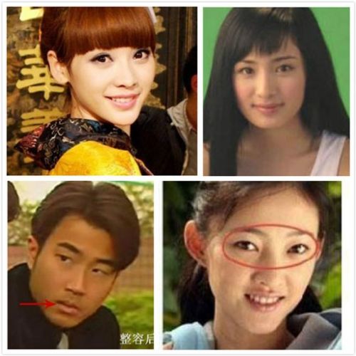 整容失敗明星整容前后圖片，深度探討與反思，整容失敗的明星，前后對比與深度探討反思