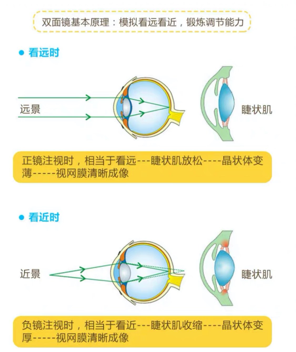 糾正眼睛近視的有效辦法，糾正眼睛近視的有效方法總結(jié)